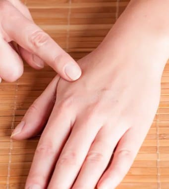 Large Intestine 4 is a terrific point for relieving the symptoms of heat which are common in Menopause Rage.